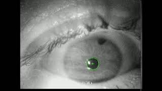 11. Real-time pupil detection on ExCuSe XI