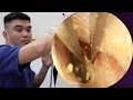ASMR耳掃除:初体験!自宅でできる本格プロ仕様耳かき🛏️