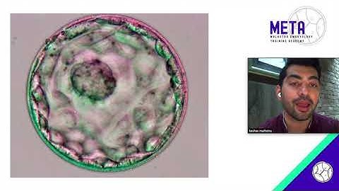 Prioritising embryos for transfer : Dr. Keshav Malhotra