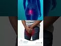 Did You Know This Vaccine Can Prevent Cervical Cancer? | HPV Vaccine Explained