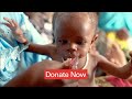 Donate to fight malnutrition crisis