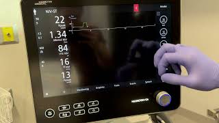 Esophageal Balloon Catheter Insertion and Monitoring Using a Hamilton C6 Ventilator