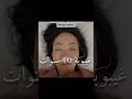 غيبوبة 10 سنوات 