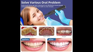 Unboxing plaque remover for teeth cleaning, Aultroncare AC-320
