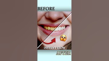 The Easiest Teeth Whitening Trick in Photoshop! #shorts #photoshop #tricks