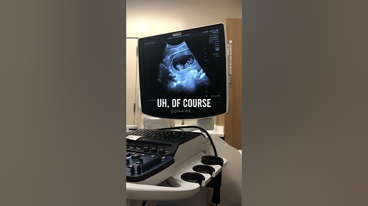 Well that was unexpected!