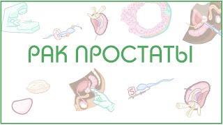 Рак простаты