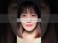 村田大典先生の二重比較動画🌟#shorts