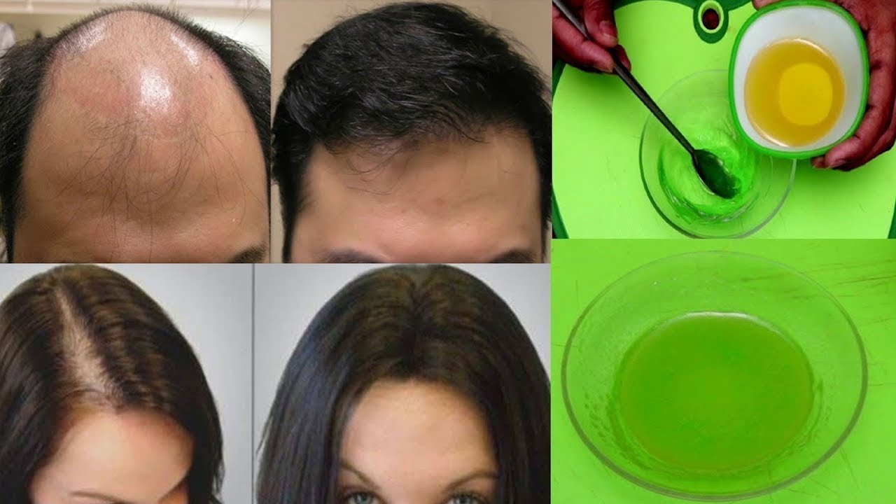 Hair Fall Home Remedies YouTube Hair Fall Home Remedies YouTube