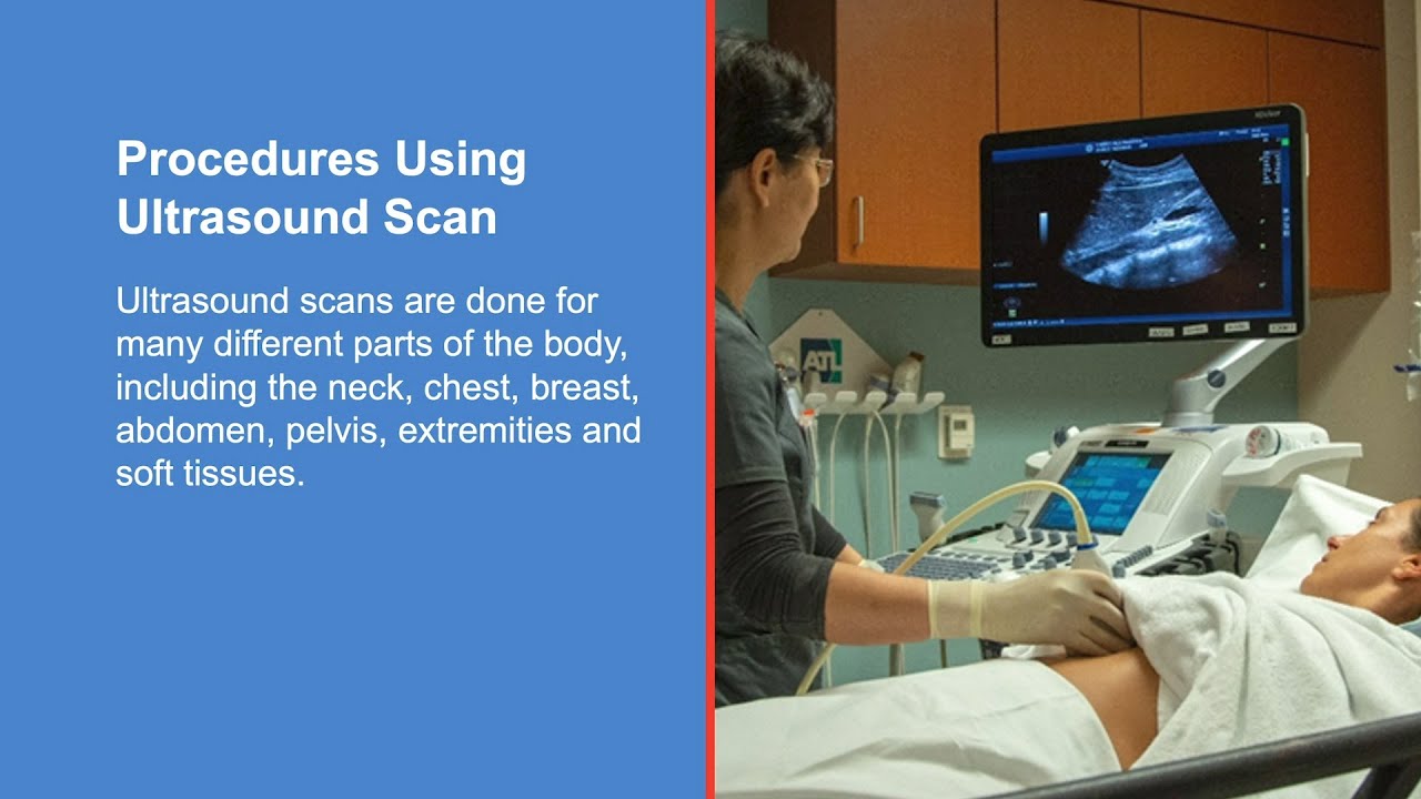 to expect during an ultrasound scan - YouTube