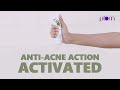 #AntiAcneAction activated with Plum Green Tea Face Wash & The Acne-Fighting Squad 