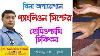 গ্যাংলিওন সিস্টের হোমিও ঔষধ|Homeopathic treatment of ganglion cyst|Homeopathic medicine for ganglion