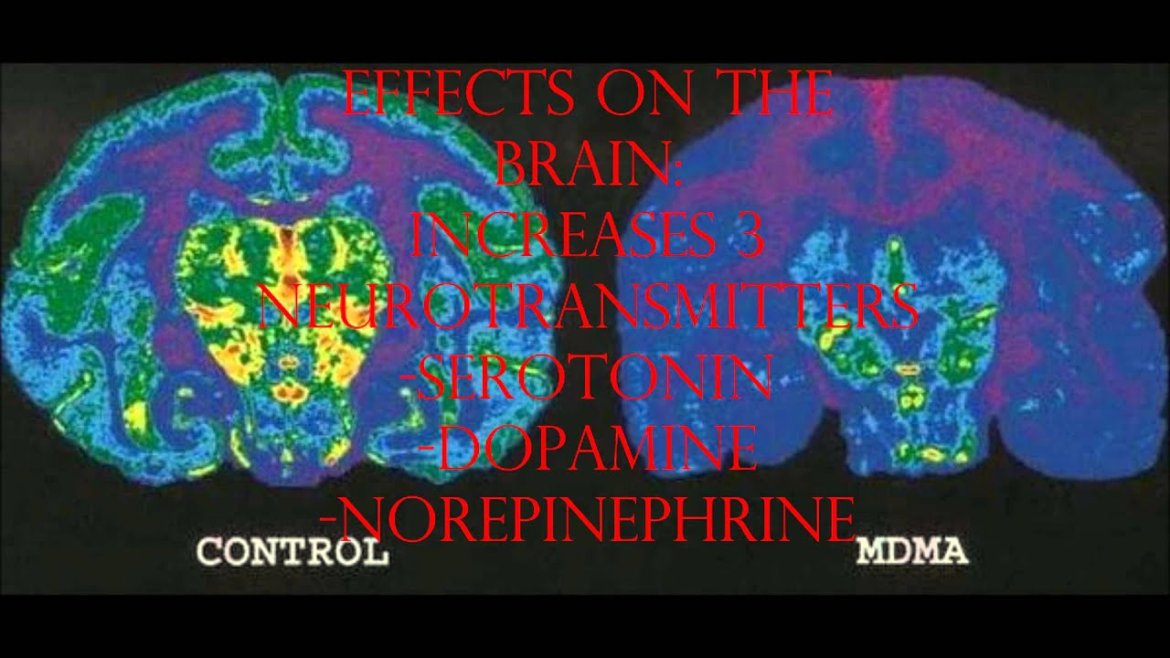 This Is Your Brain On Drugs Gif