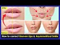 How to correct Uneven Lips, Crooked Lips, Asymmetrical smile by Facial &amp; Lips Exercises.