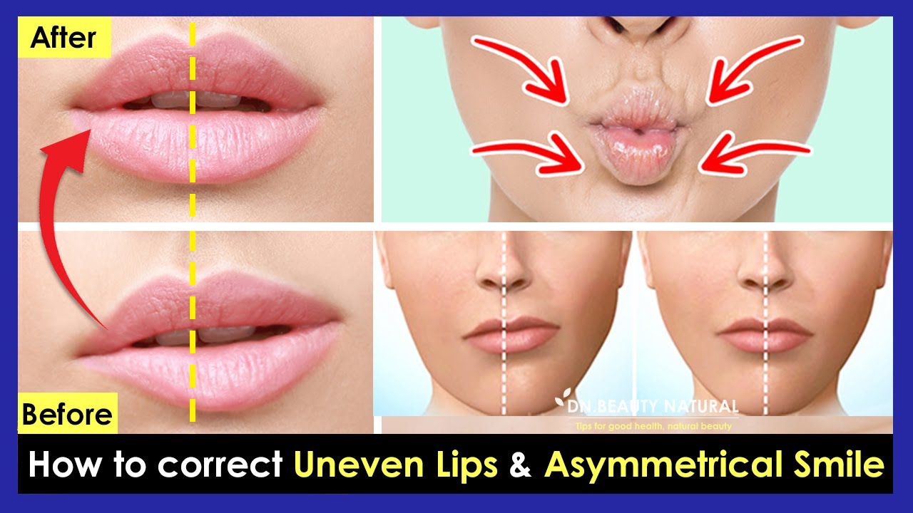 ⁣How to correct Uneven Lips, Crooked Lips, Asymmetrical smile by Facial & Lips Exercises.