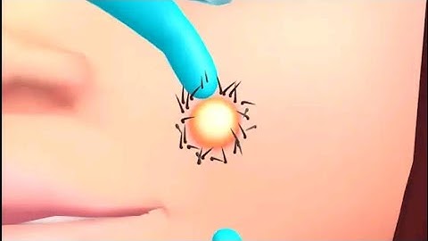 Parasite Cleaner in All Levels Game Mobile New Trailer Update Gameplay iOS,Android Walkthrough AKPXM