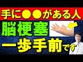【命運を分けます】あなたの手の異変・違和感…実は「脳梗塞の初期サイン」「前触れ」かも。医師が教える、見逃さないための初期症状と予防法。