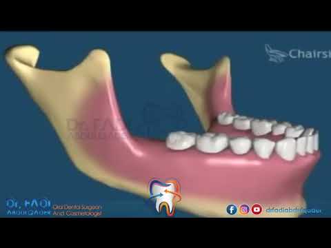 ضروس العقل الحلقة ٣