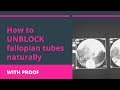 How to unblock fallopian tubes naturally with proof!