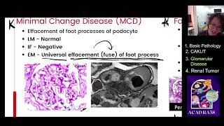 RAID211 Lecture 13: Glomerular disease part 2 by Ice RA58