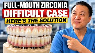 How We Solved a Difficult Full-Mouth Case | Creating Natural Esthetics with Ceramic