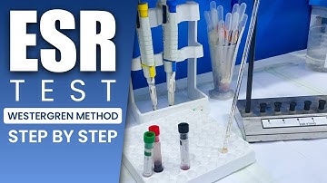 How to Perform ESR Test Step by Step | Westergren Method Tutorial | MedilabLife