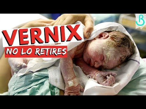 Vídeo: Vernix Caseosa: Beneficios Para El Bebé