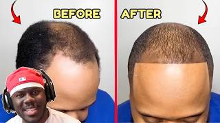CAN THIS PROFESSIONAL BARBER SAVE REASE HAIR!
