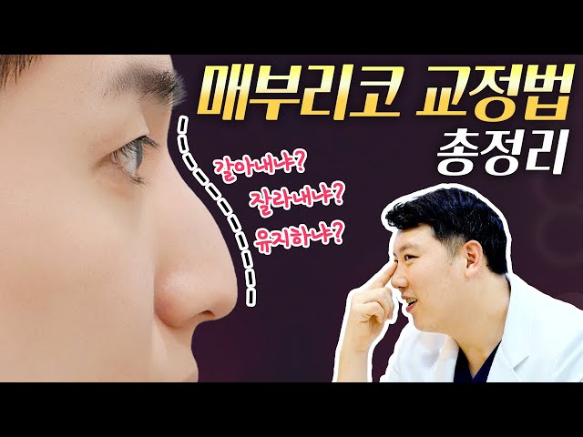갈아내냐? 잘라내냐? 유지하냐? 👃매부리코 교정법 총정리!!