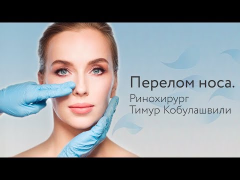 Перелом носа. Ринохирург Тимур Кобулашвили