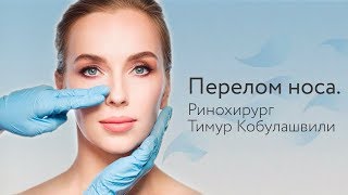 Перелом носа. Ринохирург Тимур Кобулашвили Перелом носа. Ринохирург Тимур Кобулашвили