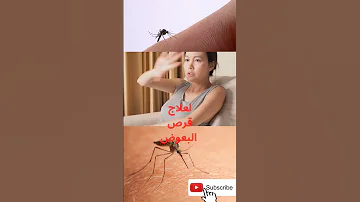طريقة فعالة للتخلص من الاحساس المزعج لقرص البعوض Shorts 