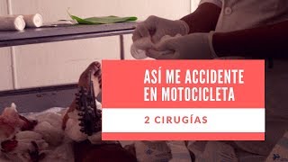 Así fue el accidente que tuve ?? ?// Nutriólogo Gerick De Luna // Me realizaron 2 cirugías ?????