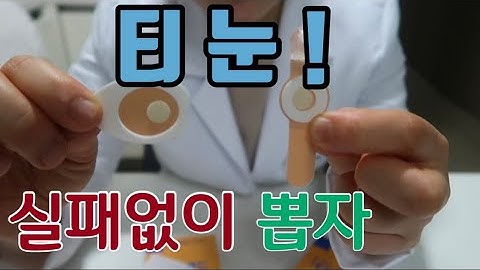 티눈! 실패없이 뽑는 법, 티눈 제거하는 법