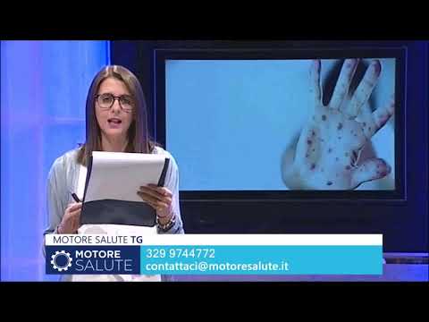 Video: Varicella: Sintomi, Trattamento, Cause, Prevenzione, Foto