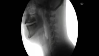 X ray: A person swallowing water! Amazing! ( Funny Vines )