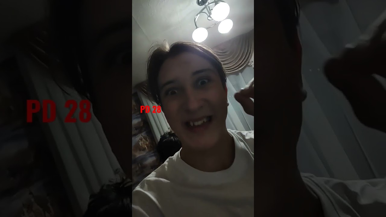 PD 28 