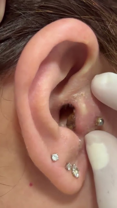 Problem #piercing #bodymodifications #newpiercing #earrings