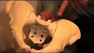 Sacroiliac Joint Fusion Animation
