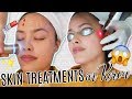GETTING SKIN TREATMENTS IN KOREA | Experience, Healing Time, & Results
