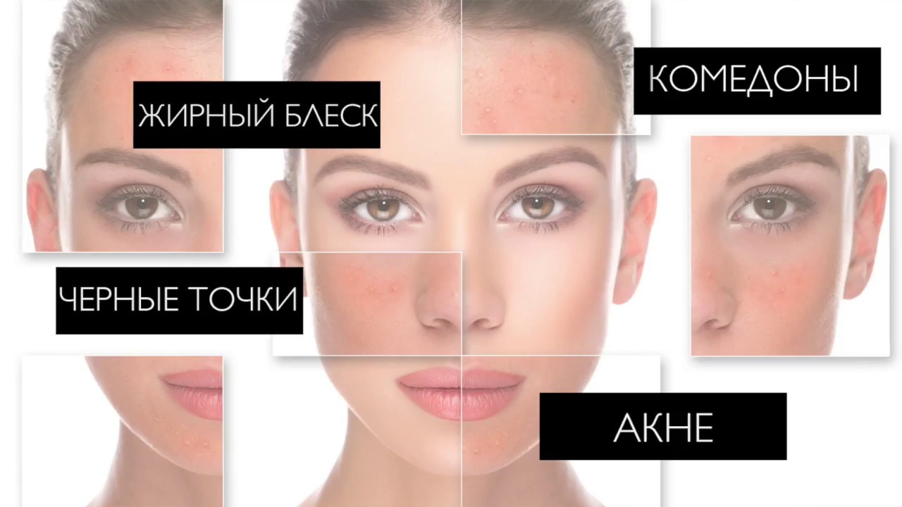 Ограничение использования агрессивных средств