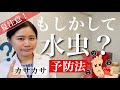 水虫を防ぐために絶対知っておくべきこと!足のカサカサ・かゆい【薬剤師が解説】