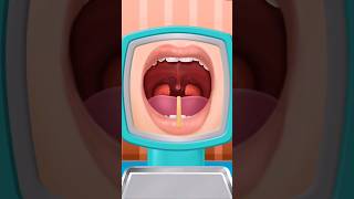 ASMR Tonsils Treatment | Animation asmr tonsils animation