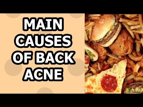 How To Get Rid Of Back Acne -  Causes of Back!!