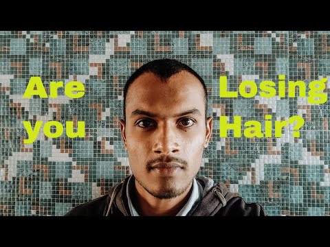 losing-hair?-|-hair-fall-|-hair-loss-|-hair-follicles-|-man-matters