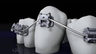 Bioquick Product Film Forestadent Pinkblue