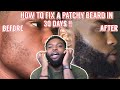 HOW TO FIX A PATCHY BEARD IN 30 DAYS (SECRET SAUCE INCLUDED 🤫)