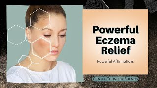 ❋ Eczema Healing! ~ Powerful Eczema Relief + Beautiful Healthy Skin ~ Gentle Thunder Sounds