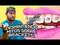 ¿HASTA QUE EDAD SE PUEDEN PONER BRACKETS? ¡14 MITOS DESMENTIDOS DE LA ORTODONCIA en tus DIENTES!