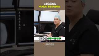 노안으로 인한 백내장의 원인과 종류는?